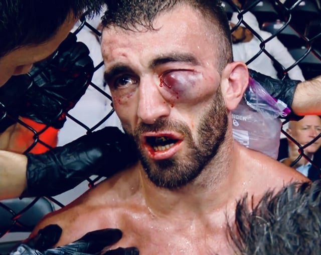 Anatomia de uma lesão devastadora Fratura orbital de Pitbull expõe riscos