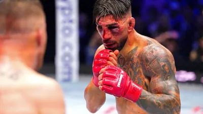 Gaethje prometeu marcar o rosto de Topuria — e cumpriu cada palavra